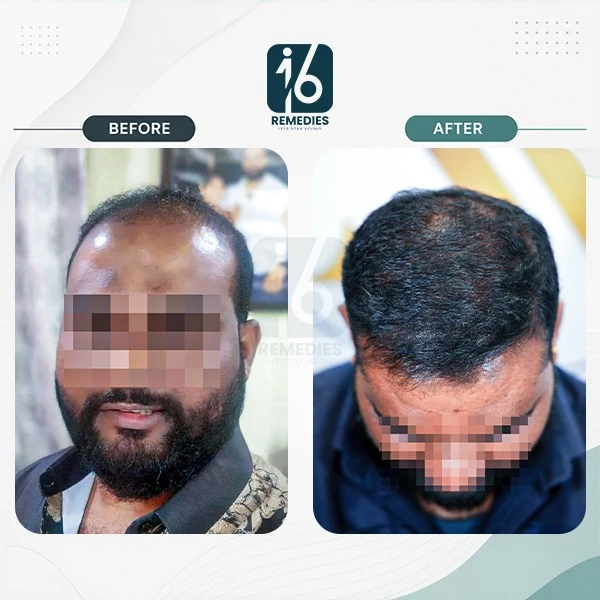 Medicine Result